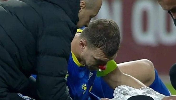 Fenerbahçe'ye Edin Dzeko'dan kötü haber! Kırık şüphesi var
